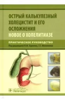 Острый калькулезный холецистит и его осложнения. Новое о холелитиазе. Практическое руководство