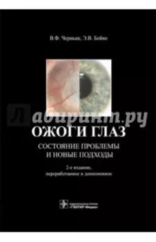 Ожоги глаз. Состояние проблемы и новые подходы