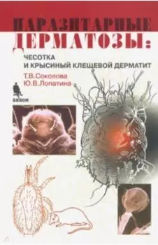 Паразитарные дерматозы. Чесотка и крысиный клещевой дерматит