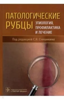 Патологические рубцы. Этиология, профилактика и лечение