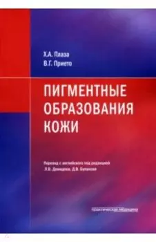 Пигментные образования кожи
