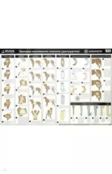 Плакат "Техника наложения повязок" (в тубусе)