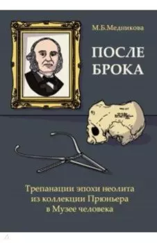После Брока. Трепанации эпохи неолита из коллекции Прюньера в Музее Человека в Париже