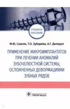 Применение микроимплантатов при лечении аномалий зубочелюстной системы, осложненных деформациями