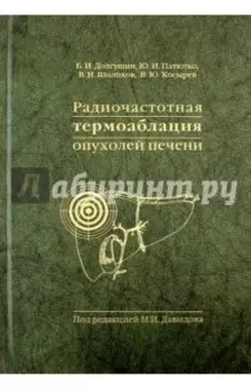 Радиочастотная термоаблация опухолей печени