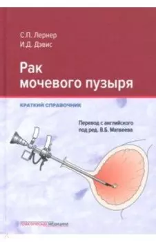 Рак мочевого пузыря. Краткий справочник