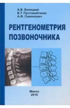 Рентгенометрия позвоночника