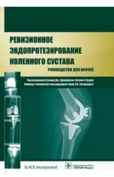 Ревизионное эндопротезирование коленного сустава. Руководство для врачей