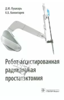 Робот-ассистированная радикальная простатэктомия. Руководство для врачей