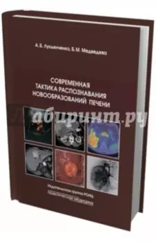 Современная тактика распознавания новообразований печени