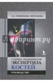 Судебно-медицинская экспертиза костей