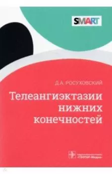 Телеангиэктазии нижних конечностей