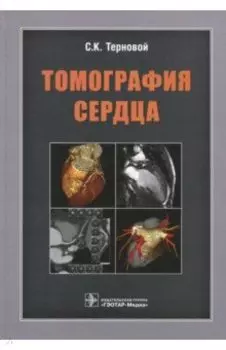 Томография сердца. Руководство для врачей
