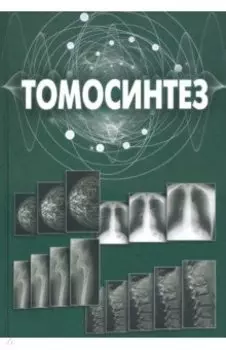 Томосинтез