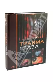 Травма глаза