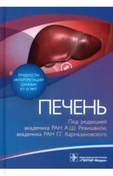 Трудности интерпретации данных КТ и МРТ. Печень