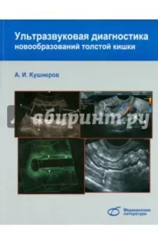 Ультразвуковая диагностика новообразований толстой кишки