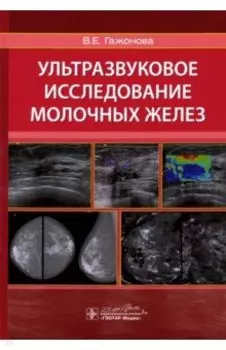 Ультразвуковое исследование молочных желез. Руководство