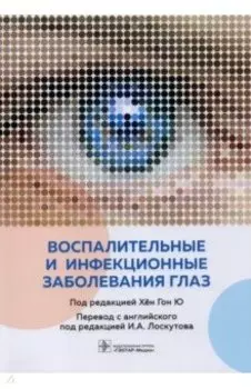 Воспалительные и инфекционные заболевания глаз