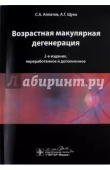 Возрастная макулярная дегенерация