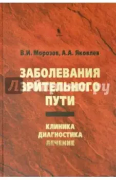 Заболевания зрительного пути. Клиника. Диагностика. Лечение