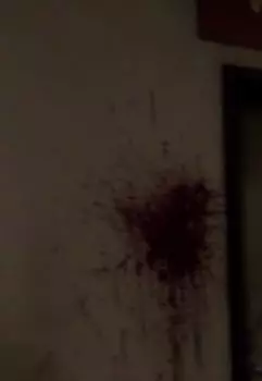 О хилере бедном замолвите слово.