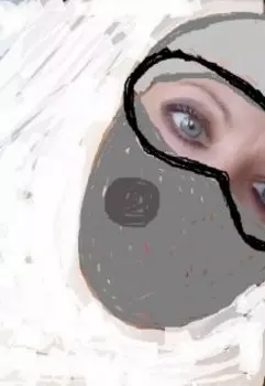 Постковидный синдром 2