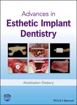 Advances in Esthetic Implant Dentistry