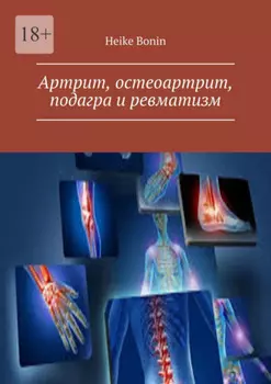 Артрит, остеоартрит, подагра и ревматизм