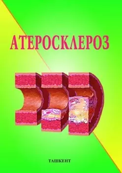 Атеросклероз
