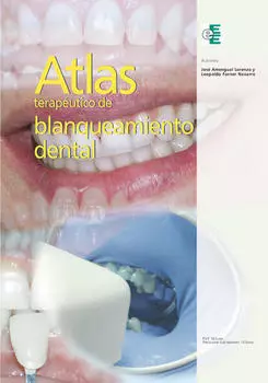 Atlas terap?utico de blanqueamiento dental