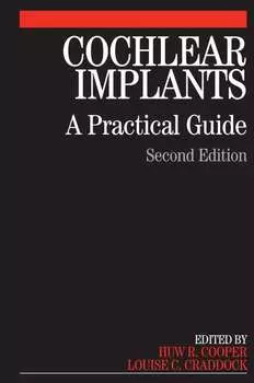 Cochlear Implants