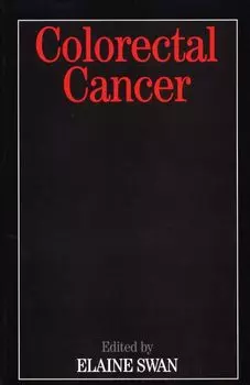 Colorectal Cancer