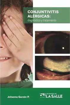 Conjuntivitis al?rgicas