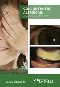 Conjuntivitis al?rgicas