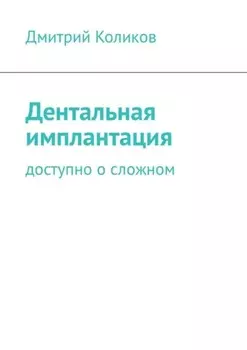 Дентальная имплантация. Доступно о сложном