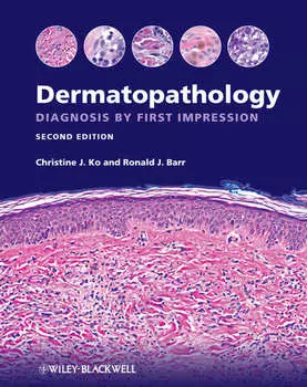 Dermatopathology. Diagnosis by First Impression