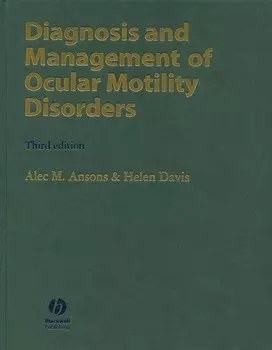 Diagnosis and Management of Ocular Motility Disorders