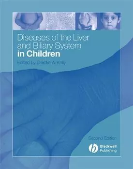 Diseases of the Liver and Biliary System in Children