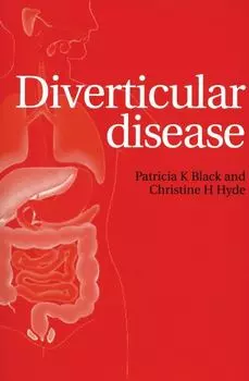 Diverticular Disease