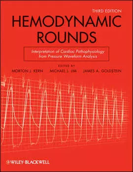 Hemodynamic Rounds
