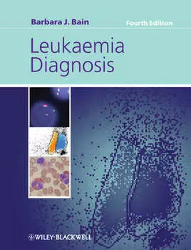 Leukaemia Diagnosis