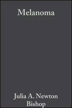 Melanoma