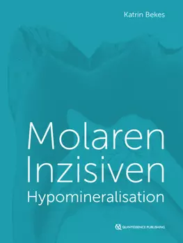 Molaren-Inzisiven-Hypomineralisation