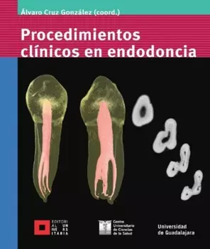 Procedimientos cl?nicos en endodoncia