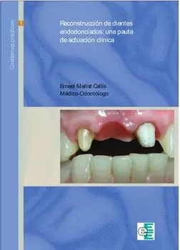 Reconstrucci?n de dientes endodonciados