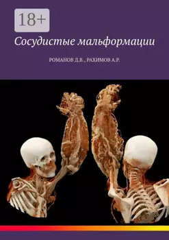 Сосудистые мальформации