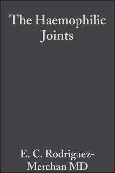 The Haemophilic Joints