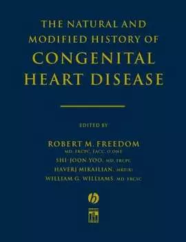 The Natural and Modified History of Congenital Heart Disease