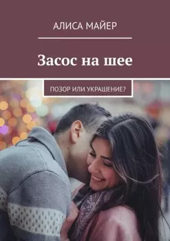 Засос на шее. Позор или украшение?
